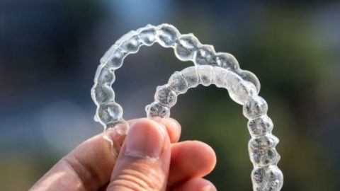 invisalign worth it