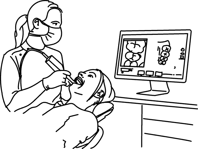 Invisalign scanner