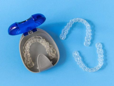 Invisalign Cost: How to Find the Best Price for Invisalign